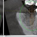 뿌리치과기공소 이미지