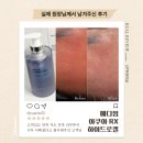 [후기/메디썸] 아쿠아 RX 하이드로겔 원장님 리얼리뷰