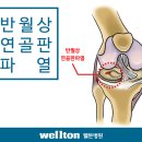 반월상연골판 파열 증상,치료 & 회복기간, 관절내시경 수술 후 재활, 관절내시경수술 잘 하는 곳,추천 이미지