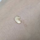 주식회사 노바메디코리아 | 뾰루지 짜지 말고 얹으세요! 여드름 자국 미백까지 히루스카 포스트아크네 클리어 스팟케어 실사용 후기