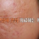 수원-1093 티스토리