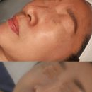 페이스터치