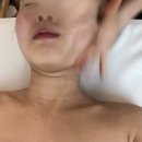 이레미용재료 | [분당 피부샵] 야탑역 근처 피부샵 "이레바디스킨" 작은 얼굴 윤곽관리 후기