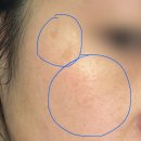 유한킴벌리(주)김천공장 | 김천 구미 피부관리 주근깨, 흑자, 잡티 제거 내돈내산 리뷰 진앤뷰티