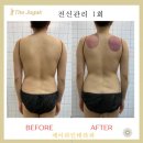 휴가테라피