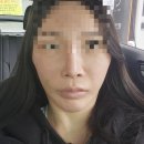 젤성형외과의원 이미지