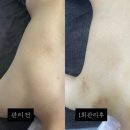바디 아티스트 | 하대동 수기관리 강선뷰티동안연구소 진주 바디관리 통증관리 2회차 효과 후기