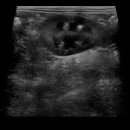 엔도소노 이미지