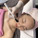 라라에스떼 | 대구피부관리 [라플러스에스떼] 라라필 후기