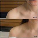 부산부암동우체국 | [뽈뽈리뷰]뷰티포엘 - 당감동웨딩케어추천 / 부암동에스테틱