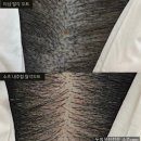 진작 | 파주두피문신 왜 진작 안 했을까? 솔직 후기