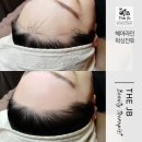 제이비라인 이미지