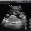 마이비산부인과의원 이미지