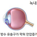 참약사 진접우리약국 | [진접우리약국] 녹내장 영양제(1)