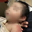 맘시티소아청소년과의원 네이버블로그