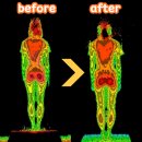 우리들척추운동센터 | 성장기라 더 중요해요! 중학생 척추측만증 교정 운동 리얼 후기