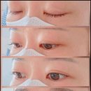 아이케이솔루션 | 청라속눈썹펌 시술 성공을 위한 단계별 완벽 관리 및 디자인 솔루션