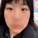 아로마테라피에스테틱 | 광명 피부관리 엘에스아로마 에스테틱 베이직테라피 수분보습 케어 솔직후기