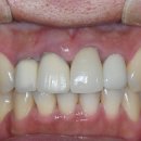 엠웍스 치과기공소 이미지