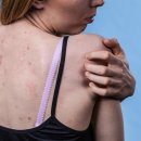 핑크메드 이미지