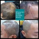 이혜주 뷰티샵 | 노원눈썹 잘하는 이혜주뷰티샵에서 두피디자인케어받은 후기