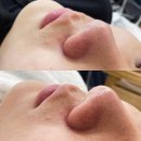 고원장의모공세척테라피구월점