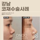 온도성형외과의원 네이버블로그