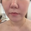 부산 에스테틱 더노블메디센터 일요일도 하는 동래 피부관리실