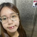 새대구약국 | [공지] 대구 편평사마귀 제거 얼굴 전체 무제한• 내돈내산 리얼 후기