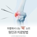 부산 정형외과 젊다고 안심할 수 없는 무릎 '뚝' 소리의 원인