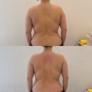 산후 관리중인 일상(단유마사지, 등관리/손목 통증- 보호대)