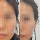 어본에스테 피부관리 포항점