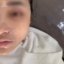 하삼동연산더샵파크시티점 | 연산동피부관리 올가드림뷰티 연산더샵파크시티점에서 모공디톡스 관리후기