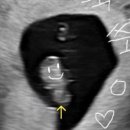 르샘여성의원 이미지