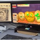 열린치과기공소 이미지