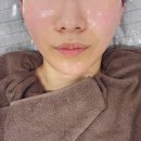 [관악구 피부관리] 서울대입구 피부관리 땅콩형 얼굴 리프팅맛집 에스테틱 다은 업핏 프로그램 후기