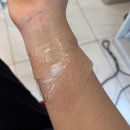 리마인드피부과의원 | 유명해서 예약하기 어려운 선릉역 힐비뇨기 피부과 가성비 얼굴 잡티제거 내돈내산 후기 및 예약 성공 꿀팁