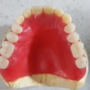 이유 치과기공소 이미지