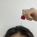 빈 헤어라인