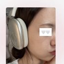 명한의원 | 내돈내산 서면 한의원 편평사마귀 제거 후기(일주일차 날짜별 매일기록)