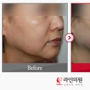 티나성형외과의원 이미지