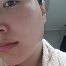 몽니스샵 - 남구 팔등로51번길 30-1 | 리프팅마스크팩 내추럴샵 레드캣 탄력마스크팩 사용후기