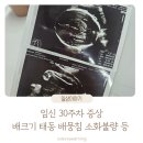 가스트론 | 임신 30주차 임신 중기 증상 태동 배뭉침 입덧 배크기 몸무게 변화