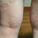 장대녕 | [공지] 신장병 케어 장대녕? 사람의 수명은 이것과 밀접한 관련이 있다? 장대녕 복용 리얼후기