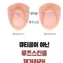 네일루스