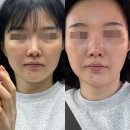 피부하라 | 야탑피부관리 :: 오아스킨 에스테틱에서 LDM 수분진정관리로 환절기 피부관리 받은 후기