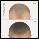 탈모왕 본점 이미지