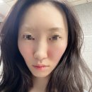비비붕붕 | 청담 피부과 피부결 피부탄력 개선 울트라클리어 후기