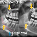 서울바정치과의원 이미지