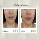 김민서피부관리 | 김해 주촌 김민서 에스테틱 - 작은 얼굴 윤곽 관리후기